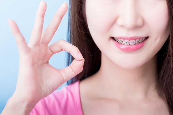 Các yếu tố ảnh hưởng đến thời gian niềng răng là gì?
