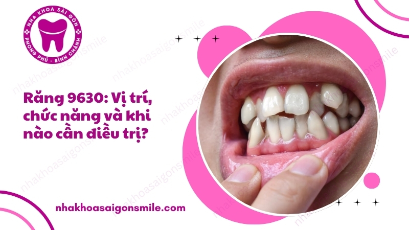 100. Rang 9630 Vi tri chuc nang va khi nao can dieu tri