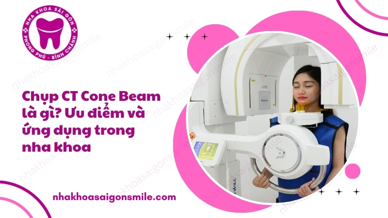 101. Chup CT Cone Beam la gi Uu diem va ung dung trong nha khoa