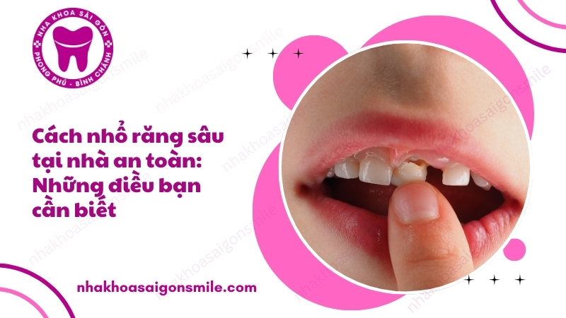 108. Cach nho rang sau tai nha an toan Nhung dieu ban can biet
