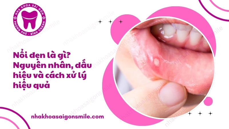 109. Noi den la gi Nguyen nhan dau hieu va cach xu ly hieu qua