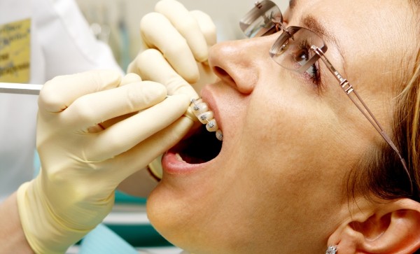 Các yếu tố quyết định niềng răng thành công ở tuổi 40