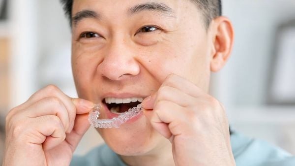 Việc niềng răng ở tuổi 40 mang lại rất nhiều lợi ích