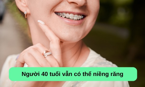 Các câu hỏi liên quan đến vấn đề 40 tuổi có niềng răng được không