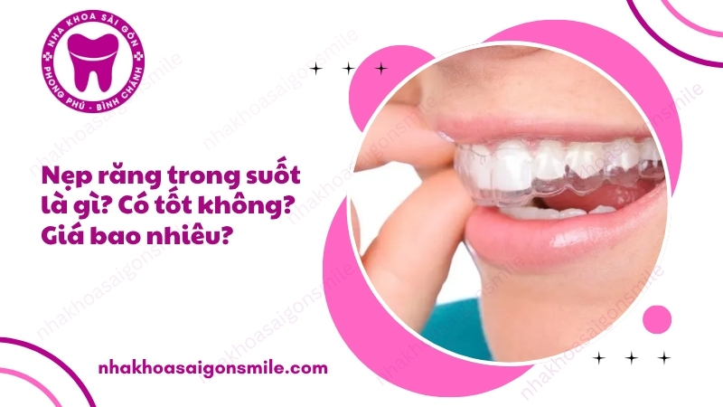 98. Nep rang trong suot la gi Co tot khong Gia bao nhieu