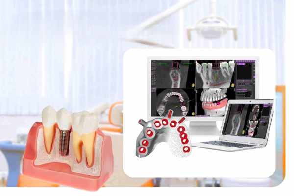 Công nghệ CT Cone Beam đã có một sự chuyển mình mạnh mẽ trong nha khoa