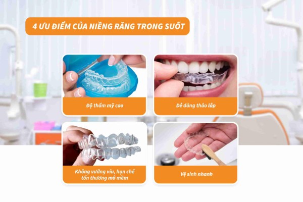 Nẹp răng trong suốt mang lại nhiều lợi ích cho người dùng