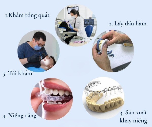 Quy trình niềng răng trong suốt tại phòng khám nha khoa