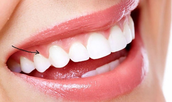 Nướu răng đóng vai trò thiết yếu trong việc duy trì sự toàn vẹn của khoang miệng