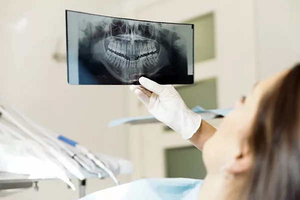 Phương pháp chẩn đoán và điều trị bệnh lý tủy răng