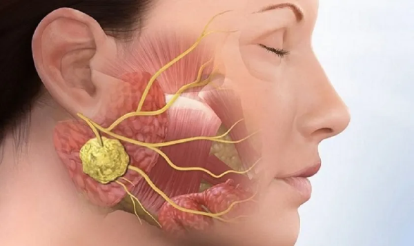 Triệu chứng nhận biết khi bị đau quai hàm gần tai bên phải