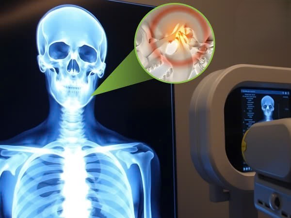 Quy trình chẩn đoán khi bị đau quai hàm gần tai bên phải