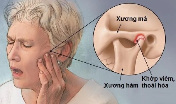 Các câu hỏi thường gặp về tình trạng bị đau quai hàm gần tai bên phải