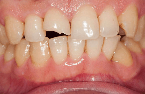 Các bệnh về răng là những bệnh lý liên quan tới cấu trúc và chức năng của răng
