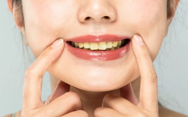 Những câu hỏi thường gặp liên quan đến các bệnh về răng