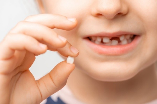 Tổng quan về việc nhổ răng sâu tại nhà
