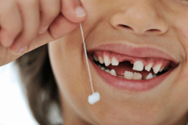 Các câu hỏi thường gặp khi áp dụng cách nhổ răng sâu tại nhà