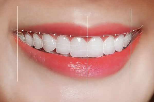 Tiêu chí đánh giá cung răng "đẹp" và chuẩn