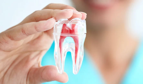 một số câu hỏi thường gặp về quy trình lấy tủy răng