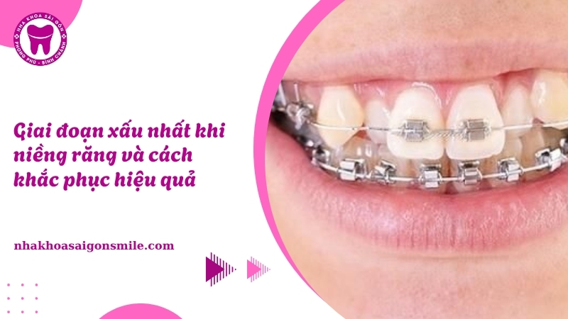 122. Giai doan xau nhat khi nieng rang va cach khac phuc hieu qua​