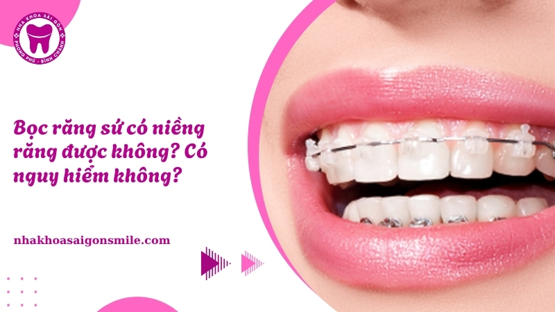 134. Boc rang su co nieng rang duoc khong Co nguy hiem khong