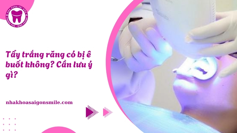 140. Tay trang rang co bi e buot khong Can luu y gi