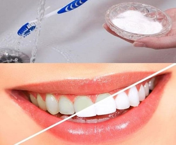 Cách sử dụng bột tẩy trắng răng đạt hiệu quả và đảm bảo an toàn