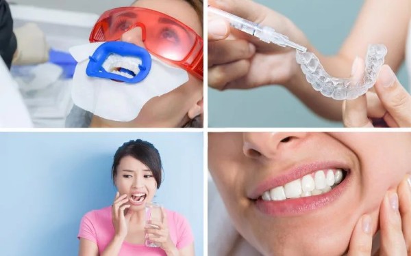 Tẩy trắng răng có gây ê buốt không?