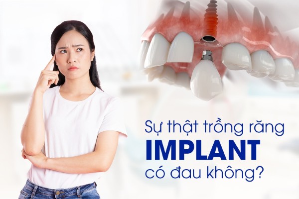 Trồng răng Implant có đau không?