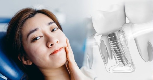 Những biến chứng và đau bất thường cần cảnh giác sau khi trồng răng implant 