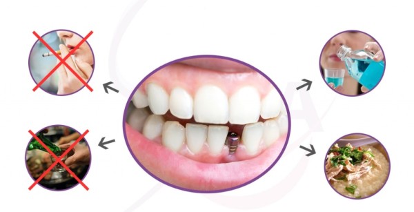 Cách chăm sóc sau phẫu thuật giúp giảm đau và nhanh hồi phục 