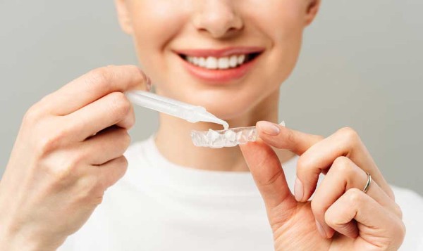 Các câu hỏi thường gặp về cách tẩy trắng răng ố vàng