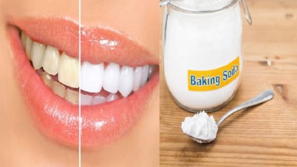 Cách tẩy trắng răng ố vàng bằng Baking soda