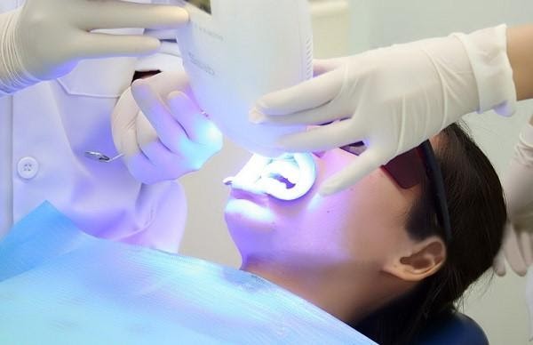 Phương pháp tẩy trắng răng chuyên nghiệp tại nha khoa