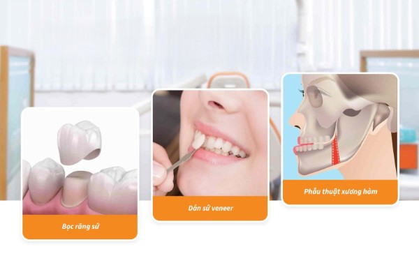 So sánh các phương pháp chỉnh răng mọc lệch không cần niềng theo các tiêu chí khác nhau