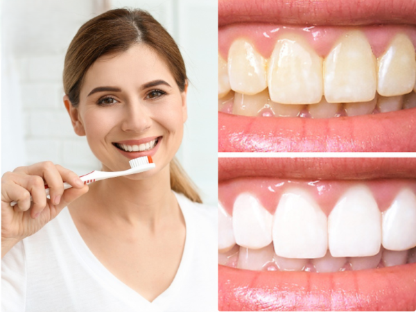 Phản hồi về hiệu quả thực tế của kem tẩy trắng răng