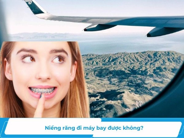 Niềng răng có đi máy bay được không?