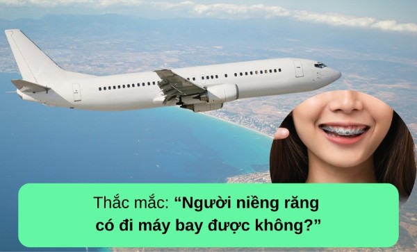 Các câu hỏi thường gặp về vấn đề niềng răng có đi máy bay được không