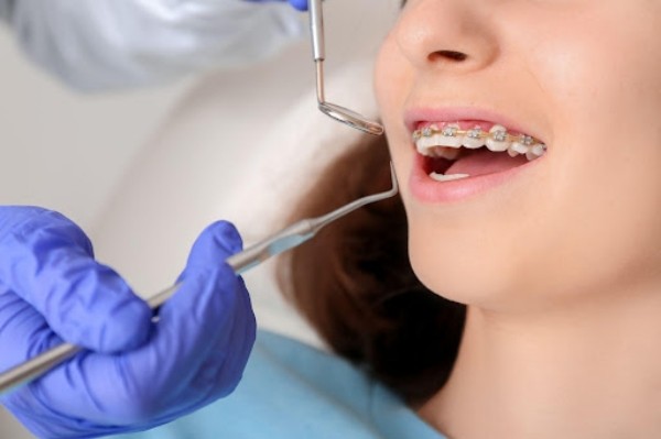 Nên tìm hiểu kỹ về các địa chỉ nha khoa uy tín để niềng răng để đảm bảo an toàn