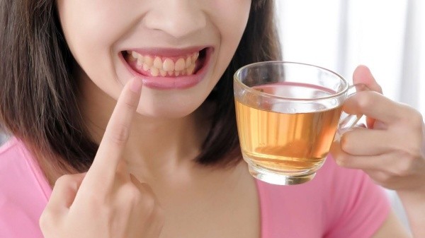 Tẩy trắng răng xong bị vàng lại do ảnh hưởng từ sinh hoạt và môi trường 