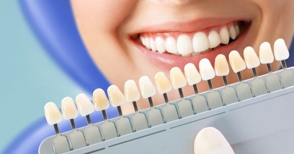 Hướng giải quyết sau khi tẩy trắng răng xong bị vàng lại