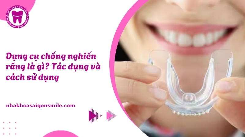 Dụng cụ chống nghiến răng là gì? Tác dụng và cách sử dụng