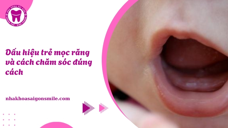 Dấu hiệu trẻ mọc răng Nhận biết và chăm sóc đúng cách