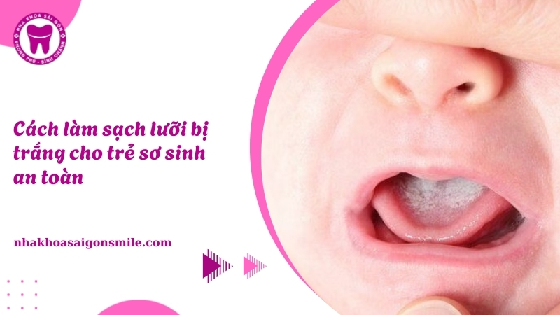 Cách làm sạch lưỡi bị trắng cho trẻ sơ sinh an toàn