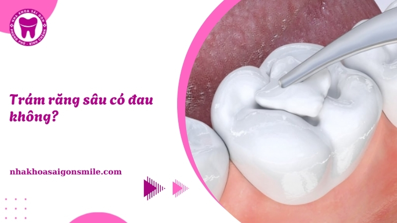 187. Tram rang sau co dau khong Cach giup giam dau hieu qua