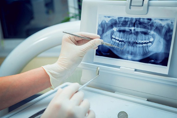 Các loại máy hỗ trợ điều trị nha khoa nâng cao