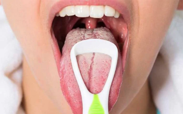 Các nguyên nhân phổ biến gây lưỡi trắng