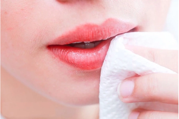 Hướng dẫn chăm sóc và phòng ngừa rộp môi tái phát