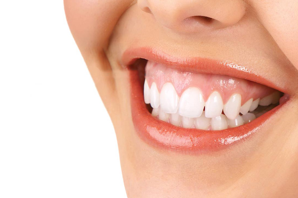 Những biến chứng sau điều trị hở lợi là gì?