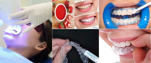 Cần xem xét mức độ an toàn của phẩm tẩy trắng răng đối với mẹ và bé